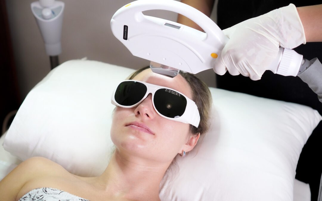 IPL Skin Rejuvenation: A Radiant Solution for Aging Concerns