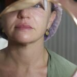 bali botox